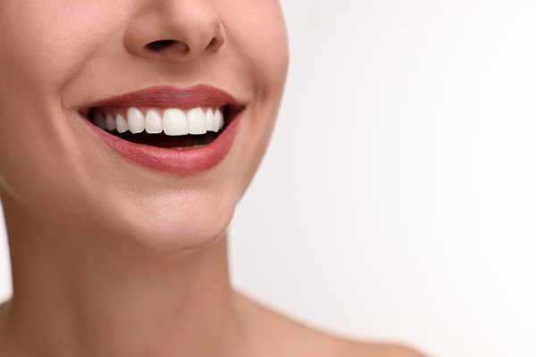 Smile Makeover Options From A General Dentist